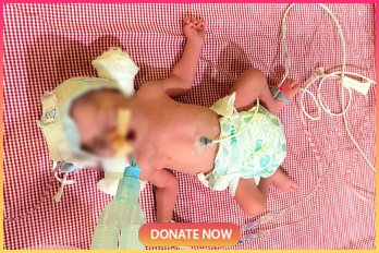 baby-of-parag Image